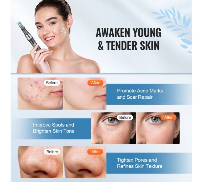 Elektrinis mikroadatų grožio rašiklis su 6 adatomis5