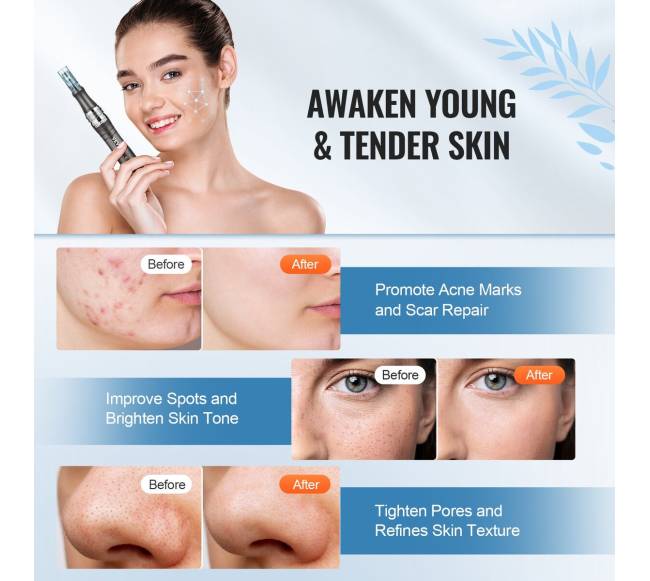 Mikroadatinis mikroįrankis su 5 adatomis5